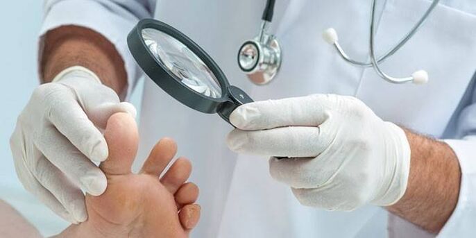 Lékař zkoumá nohu pacienta s bodcem s lupou
