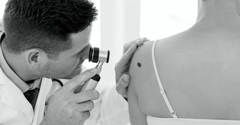 specialista diagnostikuje typ bradavice